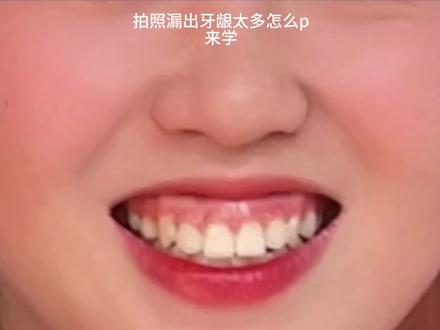 露龈笑的姐妹们这期必学#p图 #p图教程 #p图技巧 #修图 #修图教程
