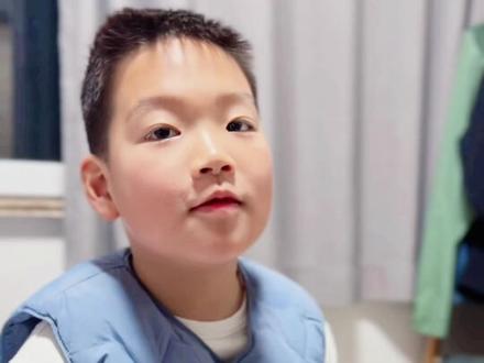 腺样体肥大到底要不要切除? 年前做了件大事,小朋友腺样体肥大,我们选择了手术,记录一下全过程,有同样问题困扰的朋友,可以在评论区讨论,分享经验。
#当我娃睡着以后的样子 #腺样体肥大 #腺样体肥大手术 #腺样体面容