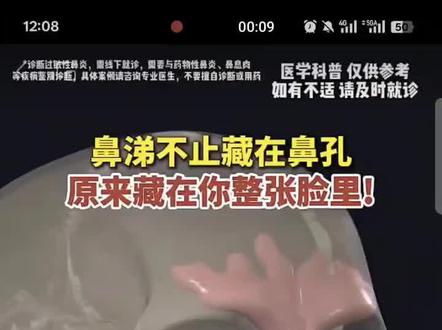 鼻涕不只藏在鼻孔里而是在整个脸部:鼻炎和鼻窦炎是怎么回事#医学科普 #过敏性鼻炎 #鼻窦炎#鼻塞#鼻出血