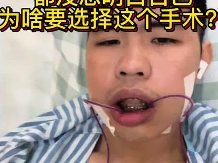 还没决定做正颌手术的各种请慎重!!!!#牙齿正畸 #正颌手术记录 #正颌正畸 #正颌术后 #正颌手术费用