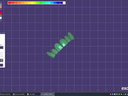 @DOU+小助手 如何把在3Shape因为 修过支台齿重扫数据或者 重扫咬合数据 在EXO流程过一遍 减少重做时间#EXOCAD #3Shape #牙齿 #保护牙齿 #牙医