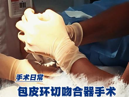 #手术室日常 包皮环切吻合器手术全过程(遮的更严实些)。#男科#懂得都懂