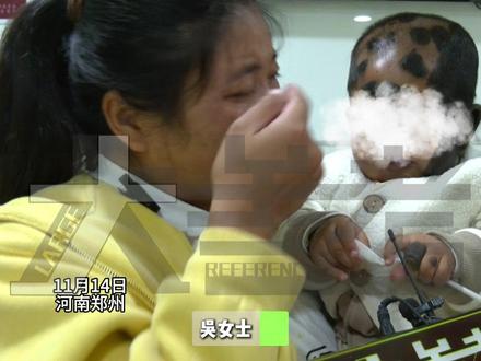 11月14日,河南郑州,“心疼!为什么我家孩子生出来是这样?”,产检时大大小小医院都去了,一路绿灯,出生后身上90%都是兽皮痣,还有新长的,皮肤科医生:基因突变,痣越大,恶变率越高,妇产科医生:常规产检检查不出皮肤颜色的异样。(艾特俩账号:@森弟 正能量 正能量;@乐宝成长记(吴)河南商丘 )#不一样的中国节气 #中国节气大雪篇 #二十四节气让生活更美好