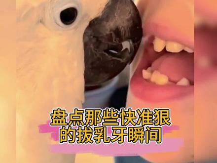 盘点快准狠的拔乳牙方法,看到最后更精彩#拔牙不过三秒 #牙齿 #第一颗乳牙 #孩子拔牙