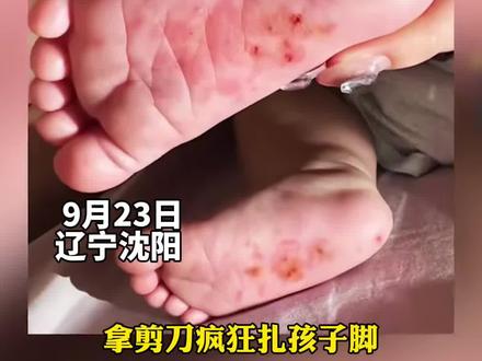 #育婴师在70天婴儿呛奶后拍打孩子后脑并用剪刀扎脚 孩子母亲已报警