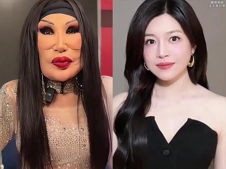 所以说,女演员还是不要轻易动脸。你看在新剧狙击蝴蝶中,42岁的#陈妍希 和36岁的#陈小芸 饰演闺蜜,两人相差近十岁,不仅看不出年龄差,而且陈妍希状态更盛一筹,在剧中原生颜值依旧能打,肌肤紧致光滑 无瑕疵,镜头怼脸也尽显通透饱满,状态稳到惊艳,简直梦回当年青春偶像剧,那些年我们追过的女孩中,那个清纯动人的沈佳宜,再看51岁的贾静雯和45岁的姚晨演闺蜜,不仅毫无违和感,而且皮肤状态更是略胜一筹。很多同期的女明星却在臃肿的道路上越走越远,过度医美,被玻尿酸硬控,整个人已经抑制不住的馒化僵硬,全然没了往日的自然舒适感。但是你又会发现近几年的女明星回春悄无声息,颖宝从发腮疲态脸到紧致建模脸,杨幂从原来的显老横秋到现在的少女感满满,还有王心凌曾经被嘲松弛的脸,到现在抬眼都是明眸桃花相,她们是怎么做到越老越年轻的?而其中的代表人物韦雪无疑是最成功的#韦雪 #面膜 #女明星