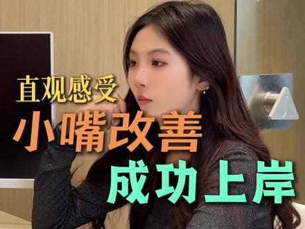 丰唇vlog#vlog日常 #医美 #丰唇 #太原