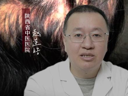 核桃,桑葚对生发有好处?#脱发 #赵连皓 #中医