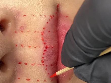 #唇型 微笑唇型设计方法,完整版设计教程来啦!
做唇前,需要对唇型进行设计,我们可以用牙签沾取色乳,假点的的方法,对应控好唇型位置,然后再去做,
很容易就能做出漂亮的年轻态微笑唇型啦!
希望大家看好方法,多去练习,有了好的唇型认知,我们再给顾客做唇,就不会轻易跑型啦!
#唇型设计 #纹唇 #半永久 #半永久培训