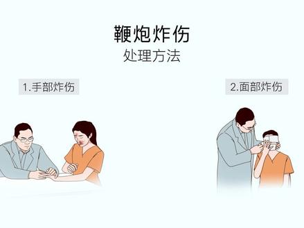 鞭炮炸伤处理方法 @抖音小助手