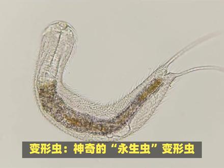 变形虫:特殊的细胞器,称为伪足,它们进行运动和摄食的主要工具 #微生物 #法式刺绣 #细菌 #微观 #微观世界