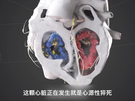 心源性猝死,记住这几点能救命! #心源性猝死 #猝死 #张雪峰 #张雪峰去世 #急救知识