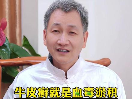 牛皮癣就是血毒淤积,不用过度治疗,教你一个土办法。 #牛皮癣 #银屑病 #大医精诚 #医者仁心