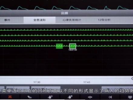 #迈瑞 N系列监护仪操作介绍 简单快捷