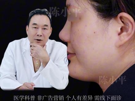 月亮脸如何改善? #月亮脸 #面中凹陷 #下巴兜