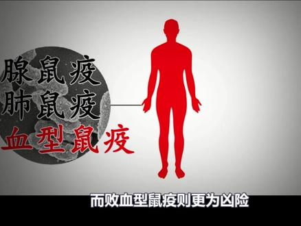 黑死病的真相 #黑死病 #历史 #人文星闪耀计划