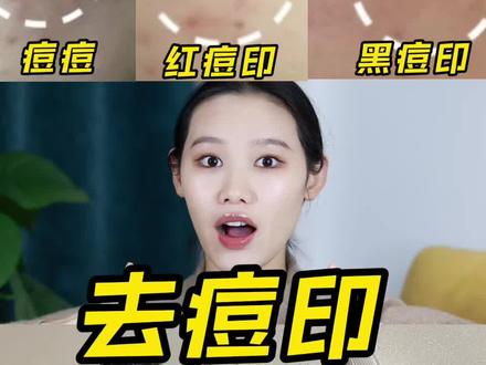 姐妹们!这才是痘印橡皮擦!#痘印