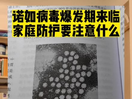 诺如病毒原来叫诺瓦克样病毒,1960年代,美国诺瓦克镇上的学校集中爆发腹泻,在粪便中第一次分离出诺如病毒,诺瓦克小镇就在最近新闻很火的俄亥俄州。