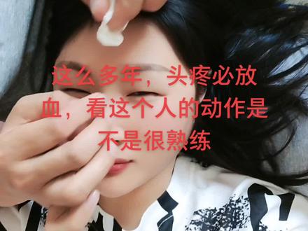 头疼多年,山西人的偏方,中暑扎手,感冒扎手,肚子疼扎手,发烧扎手,头疼扎手……总之一切难受,扎手放血皆可