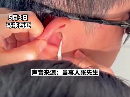 男子浮潜时小螃蟹意外爬进耳洞,上网各种找办法才将螃蟹取出,当事人:其实感觉像采耳,挺舒服的