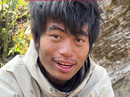 为什么39天不洗头,头发都不会油?#林北让记者别拔自己假发“拔了就粘不回去了!” #张家界七星山荒野求生