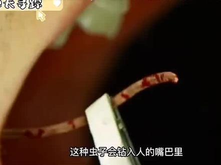 也许你买的猪肉里就寄生了绦虫#你还敢吃吗 #寄生虫的危害 #科学实验 #科普一下