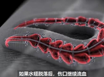 被水蛭吸血怎么办?千万不要用手扯 #动物世界 #科普知识 #自然 #科学 #吸血