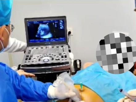 #健康守护计划#视频仅供参考如有不适请线下就医 #医学影像 #医务人员的日常 #医者仁心敬佑生命 #超声影像