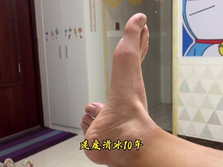 #创作灵感 #轮滑 #轮滑运动 学轮滑 滑冰没有什么扁平足@DOU+小助手