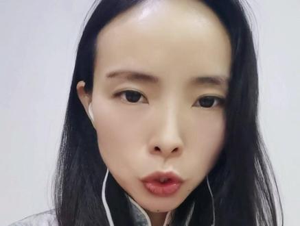 有致害第三方不要随便用你的医保报销医疗费,会涉嫌骗保#法律咨询 #法律常识 #第三方致害#医保报销#哪些情况不能用医保#新乡律师@DOU+小助手 @抖音创作者学习中心 @抖音小助手