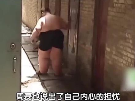 14岁男孩体重300多斤,一顿吃18包泡面,如今已去世两年 #肥胖 #社会百态 #减肥逆袭 #孙亮