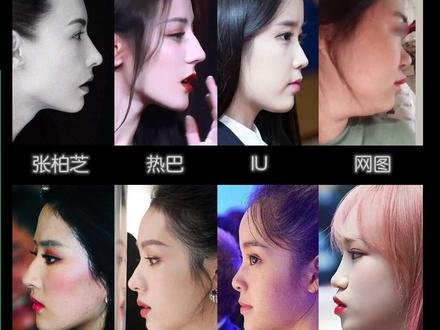 1分钟讲清什么是“鼻基底凹陷” #鼻基底 #张柏芝 #刘亦菲 #凸嘴