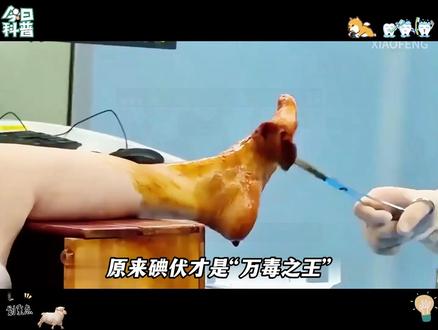 万万没想到碘伏的杀伤力竟然这么强#科普 #知识科普 #涨知识 Ψ2ONK