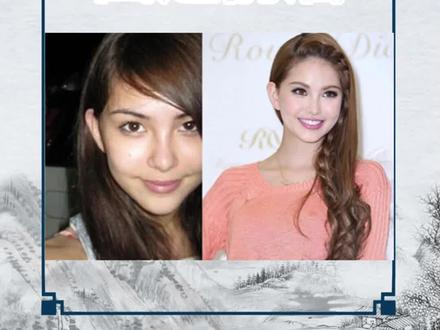 “天王嫂”这三个字的份量#昆凌 #周杰伦 #盛世美颜 #变美 #鼻型