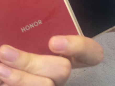 荣耀Magic v6用了没两天就滑伤了 折叠屏还贴不了膜。。。
#荣耀Magicv6 #折叠屏贴膜 #折叠屏手机