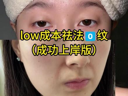 关于法令文说说我的个人经验,详细如下#真实生活分享计划#化妆基础知识#女性必看#淡纹护理