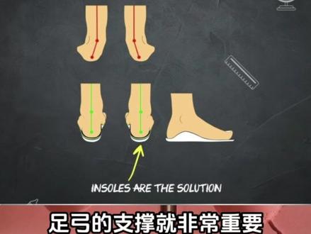 我才知道我功能性足弓塌陷,足部的问题会直接导致下肢的力线不正!错误的力线正在摧毁脚踝和膝盖,除了训练之外我们还能做什么?#体育生 #运动员 #定制鞋垫 #二十三运动科技 @二十三运动科技—定制鞋垫