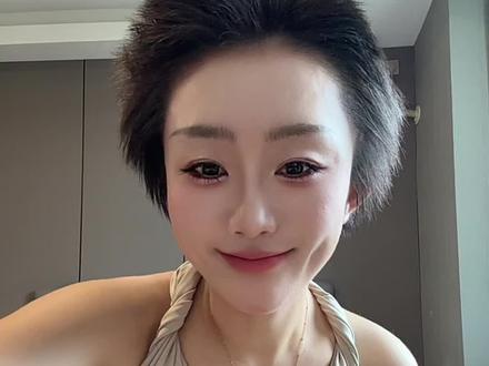 秃头少女逆袭浓密秀发!#脱发#养发