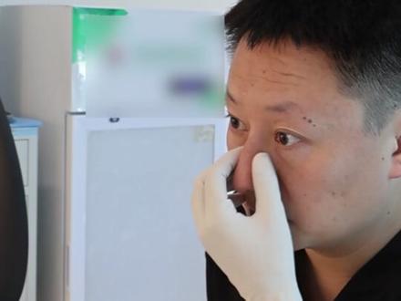 挑战:原相机自改驼峰鼻的实战行动#深圳注射医生 #注射鼻 #深圳医美 #鼻子 #变美