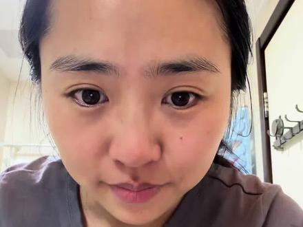 美白打卡Day8-Olay小白瓶淡斑精华+烟酰胺;#美白 #美白淡斑 #olay淡斑小白瓶 #olay #打卡