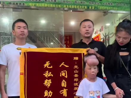 被酒精严重烧伤的信阳小女孩,小依娜来光山了,明天江小白直播献爱心活动,有意献份爱心的也可联系我。#现场实拍 #小依娜#满满的爱