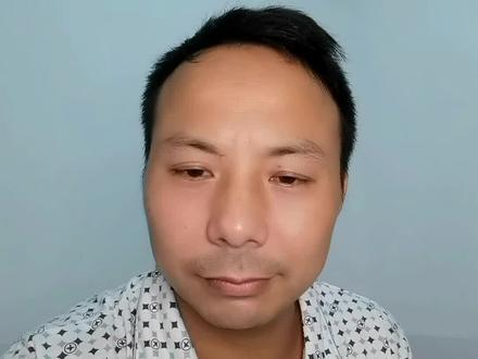 可能当中有些表述不太准确,因为有些资料在医院里,没有在我手上,但大概差不多,谢谢关心🙏🙏🙏#刘思怡