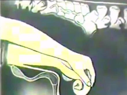 #一线兽医工作者 #三农 #自繁自养 直肠检查示意图