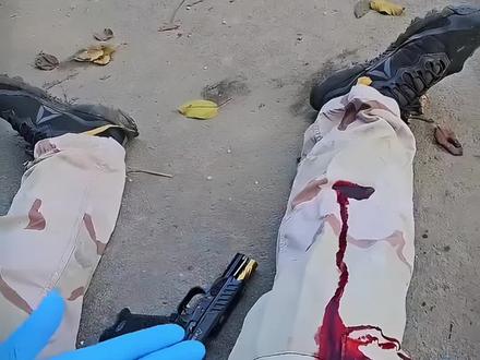 战场受伤应急处理方法#军迷发烧友 #军事科普 #军事科技 #涨知识