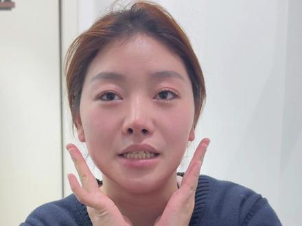 拔完牙能抽烟吗 #涨知识#潢川迎瑞口腔#潢川同城#潢川#拔牙