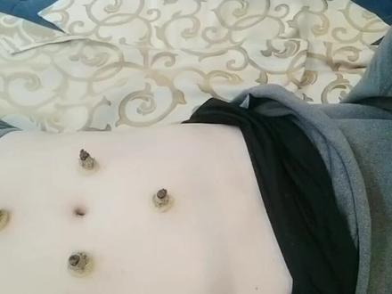 艾灸怎么样调理肠胃?跟着倪师学习很多,今天教大家在家做隔姜灸 #调理身体 #艾灸养生 #排湿驱寒 #传承中医文化