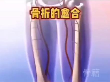 一、#骨折 #骨折的愈合 (#动画科普 #普及骨科知识 #科普 #涨知识