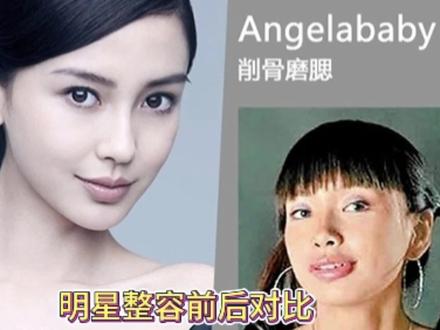 明星整容前后对比,谁是大开眼界,谁是大跌眼镜