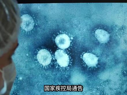 我国尚未发现尼帕病毒病例:尼帕病毒重现印度,我们需要担心吗? 我在主页商品橱窗里准备了100份口罩给大家抽奖。
我是Davinci,在这里,穿透表象,重构你的认知操作系统。
指挥中枢:@达芬奇矩阵
🌐 旗下舰队 :
🧠 @达芬奇架构师 :拆解底层逻辑与思维模型。
🛠️ @达芬奇制造局 :用第一性原理升级生产力。
⚔️ @达芬奇角斗士 :肉体是灵魂的殿堂,也是战斗的武器。
🔭 @达芬奇瞭望塔 :站在已知与未知的边界,观测未来。
🚁特种部队:
📊 @达芬奇财富 :用数据穿透迷雾,做理性的长期主义者。
🚀 @达芬奇动力 :致敬从内燃机到星舰的机械史诗。#印度 #尼帕病毒 #疫情 #中国 #防疫必胜