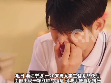 20岁男大学生没洗手挤了1颗痘痘,把自己“挤”进了ICU! 肺被“啃”出10多个洞洞! #你怎么看 #大学生 #惊不惊喜意不意外 #没想到吧我也没想到 #危险动作请勿模仿